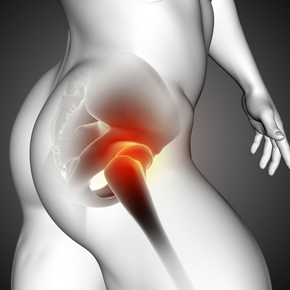 Kinesiología de la cadera: un enfoque de las acciones musculares en el plano sagital